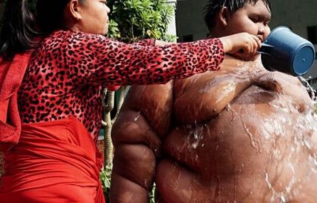 世界上最胖的孩子 印尼十岁男孩体重惊人(192公斤)
