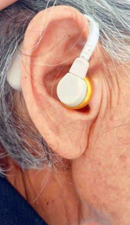 雄鹿助听器是国产的吗效果怎么样，轻中度患者效果好(国产的)